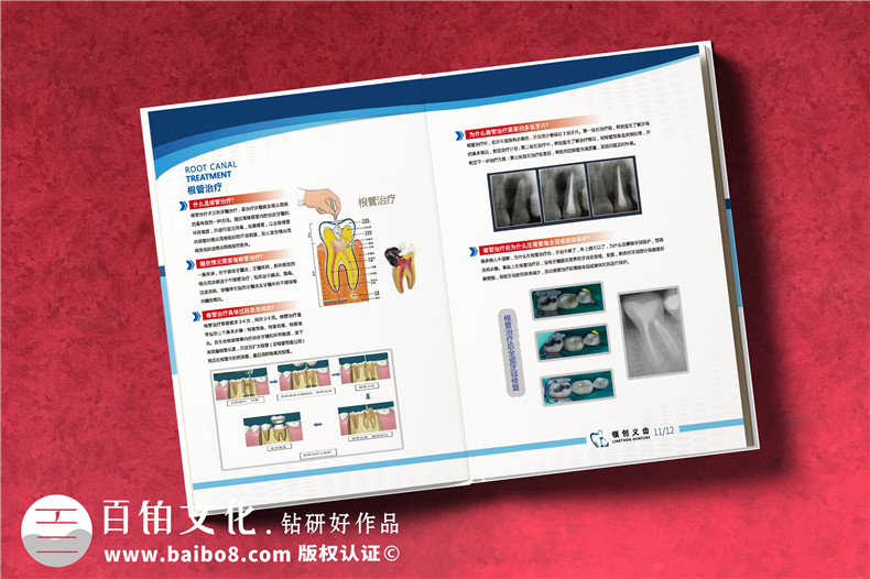 義齒畫(huà)冊怎么做-精裝高檔的義齒制作公司產(chǎn)品宣傳冊